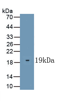 Polyclonal Antibody to Kisspeptin 1 (KISS1)