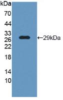 Polyclonal Antibody to L-Plastin (LCP1)