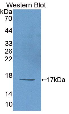 Polyclonal Antibody to Eukaryotic translation initiation factor 2D (EIF2D)