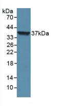 Polyclonal Antibody to Loricrin (LOR)