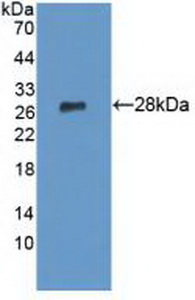 Polyclonal Antibody to Lysophospholipase I (LYPLA1)