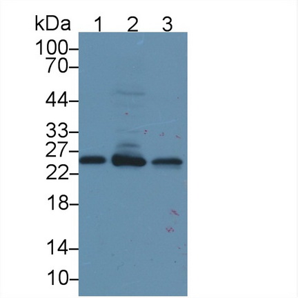 Polyclonal Antibody to Lysophospholipase I (LYPLA1)