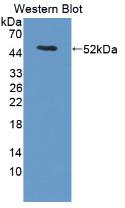 Polyclonal Antibody to Lacritin (LACRT)