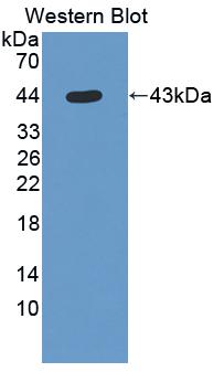 Polyclonal Antibody to Ubiquinol Cytochrome C Reductase Binding Protein (UQCRB)