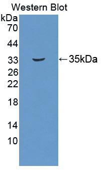 Polyclonal Antibody to Uridine Monophosphate Synthetase (UMPS)