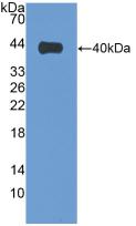 Polyclonal Antibody to Villin (VIL)