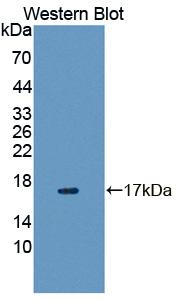 Polyclonal Antibody to Vasoactive Intestinal Peptide Receptor 1 (VIPR1)