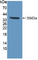 Polyclonal Antibody to Valosin Containing Protein (VCP)