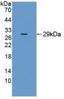 Polyclonal Antibody to Mitofusin 1 (MFN1)