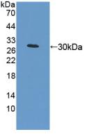 Polyclonal Antibody to Mitofusin 1 (MFN1)