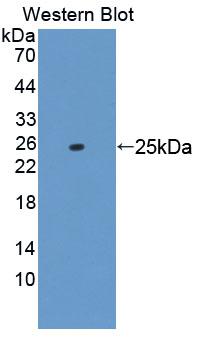 Polyclonal Antibody to Molybdenum Cofactor Synthesis 1 (MOCS1)