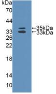 Polyclonal Antibody to Mitochondrial Tumor Suppressor 1 (MTUS1)