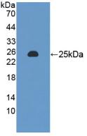 Polyclonal Antibody to Metaxin 1 (MTX1)