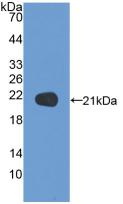 Polyclonal Antibody to N-Ethylmaleimide Sensitive Factor (NSF)