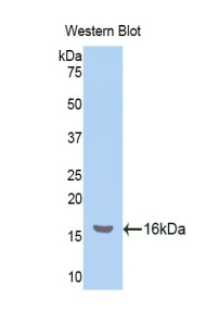 Polyclonal Antibody to Nucleophosmin 1 (NPM1)