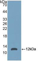 Polyclonal Antibody to Nucleophosmin 1 (NPM1)