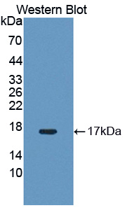 Polyclonal Antibody to Neuron Derived Orphan Receptor 1 (NOR1)