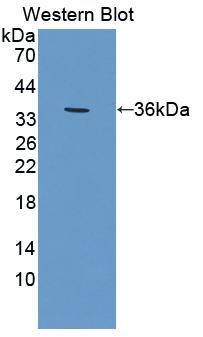 Polyclonal Antibody to Purine Nucleoside Phosphorylase (PNP)