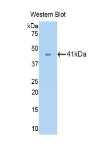 Polyclonal Antibody to Oxytocin Receptor (OXTR)