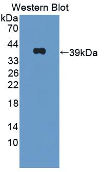 Polyclonal Antibody to Oxytocin Receptor (OXTR)