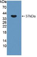 Polyclonal Antibody to Oxytocin Receptor (OXTR)