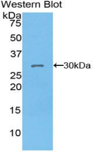 Polyclonal Antibody to Pyruvate Dehydrogenase Kinase Isozyme 1 (PDK1)