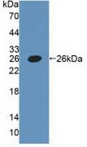 Polyclonal Antibody to Podoplanin (PDPN)