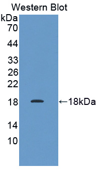 Polyclonal Antibody to Prefoldin Subunit 1 (PFDN1)