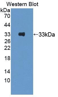 Polyclonal Antibody to Protein Kinase D3 (PKD3)