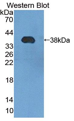 Polyclonal Antibody to Phosphomannomutase 1 (PMM1)