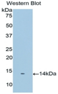 Polyclonal Antibody to Prostate Stem Cell Antigen (PSCA)