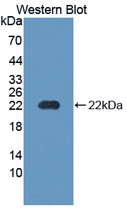 Polyclonal Antibody to Parathyroid Hormone Receptor 1 (PTHR1)