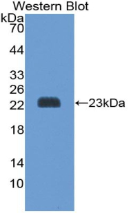 Polyclonal Antibody to Peroxiredoxin 1 (PRDX1)