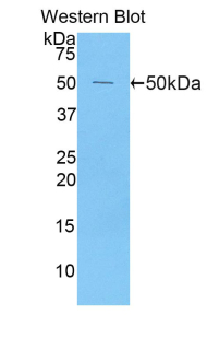 Polyclonal Antibody to Peroxiredoxin 1 (PRDX1)