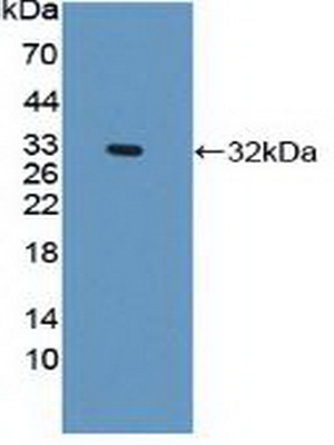 Polyclonal Antibody to Plectin (PLEC)