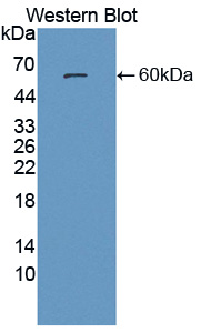 Polyclonal Antibody to Prosaposin (PSAP)