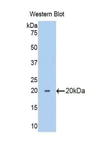 Polyclonal Antibody to Ribophorin I (RPN1)