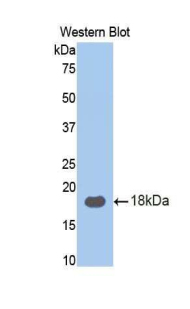 Polyclonal Antibody to Ribophorin I (RPN1)