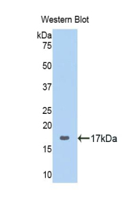 Polyclonal Antibody to Ribophorin I (RPN1)