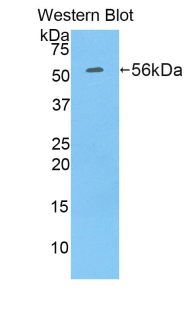 Polyclonal Antibody to Ribophorin I (RPN1)