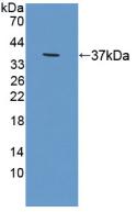 Polyclonal Antibody to Radixin (RDX)