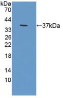 Polyclonal Antibody to Radixin (RDX)