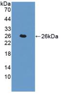 Polyclonal Antibody to Transgelin (TAGLN)