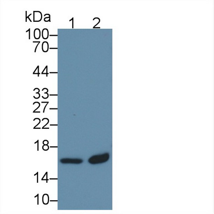 Polyclonal Antibody to Tubulin Folding Cofactor A (TBCA)