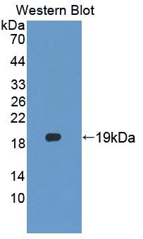 Polyclonal Antibody to Tubulin Folding Cofactor A (TBCA)