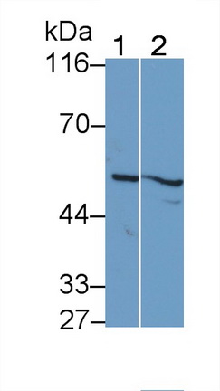 Polyclonal Antibody to Transmembrane Protease, Serine 2 (TMPRSS2)