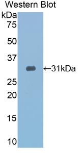 Polyclonal Antibody to Toll Interacting Protein (TOLLIP)