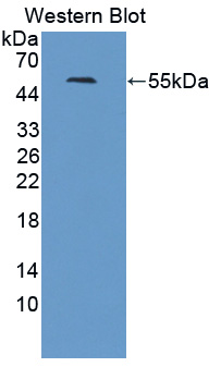 Polyclonal Antibody to Thymidine Kinase 1, Soluble (TK1)