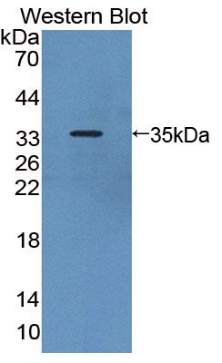 Polyclonal Antibody to Thymopoietin (TMPO)