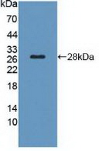 Polyclonal Antibody to Thyroid Stimulating Hormone Receptor (TSHR)